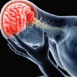 Brain-Injury-01.jpg