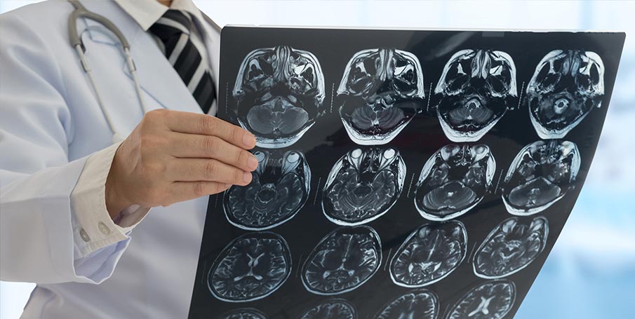 doctor sosteniendo escáneres cerebrales