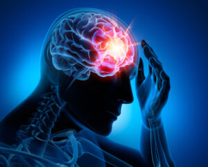 How the Law Office of John W. Redmann, L.L.C. Can Help After a Brain Injury in Gretna, LA